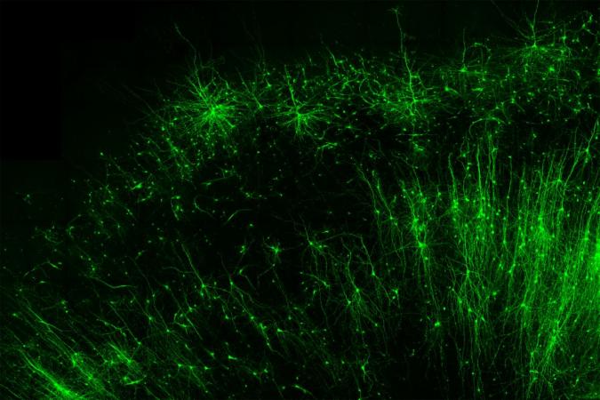 Tagging and illuminating only the inhibitory “brake” cells (green) in human brain tissue is just one of many things the new tool, CellREADR, can do