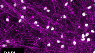 i3N iPSC-derived human neurons at 21 DPI. Nuclei are stained with DAPI, neurons are marked by Tubulin, and glutamatergic synapses by PSD95